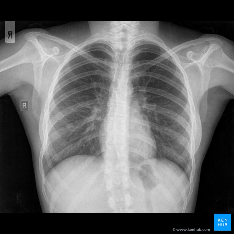 010 x ray